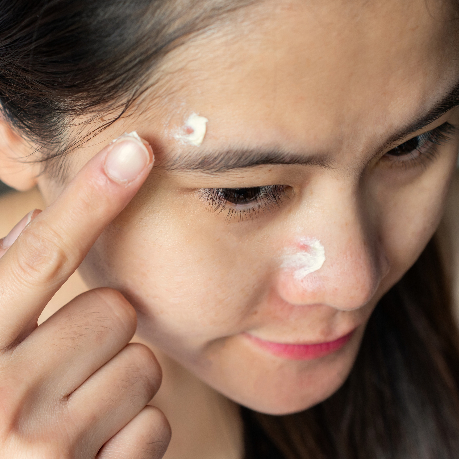 Mettalusso MORIIS vegan OTC acne fighting and anti-aging skincare spot treat or apply all over